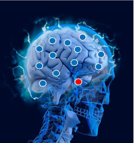 Imagen 2 Neuro